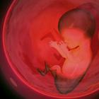 Desprendimiento prematuro de la placenta